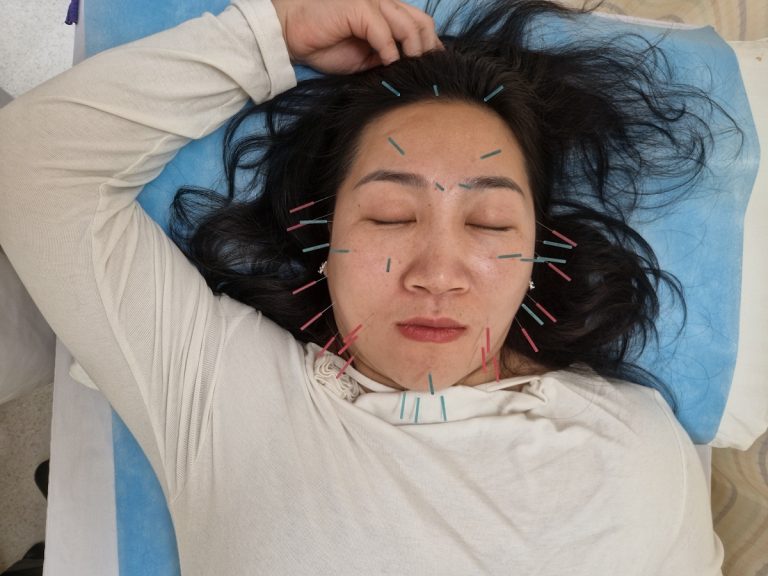 Aculifting: la bellezza naturale ispirata alla medicina cinese